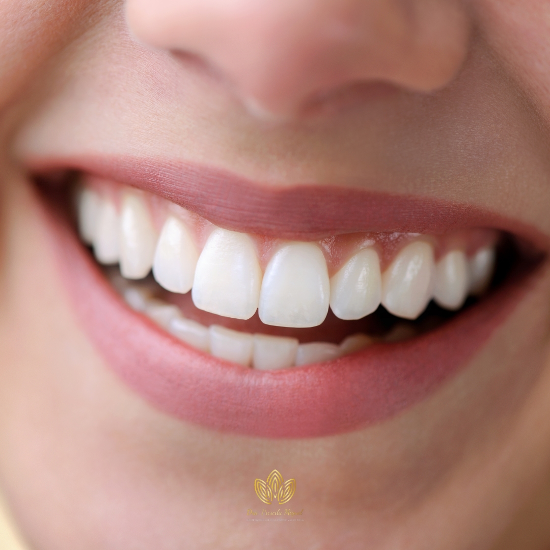 Dra. Priscila Miguel Lentes de Contato Dental #G